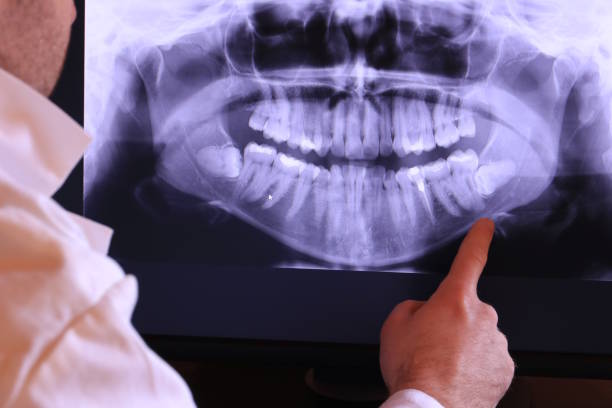 Best Pediatric Emergency Dentist in Branchville, SC