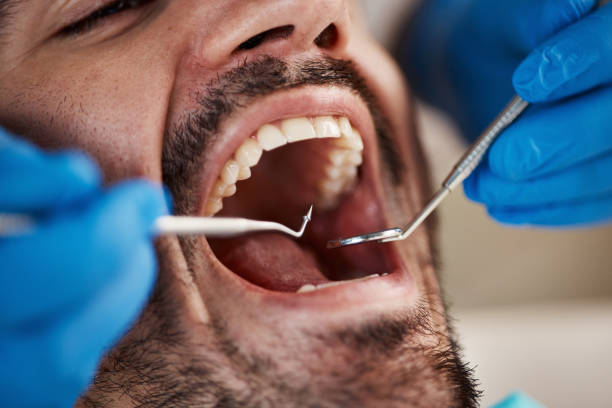 Best Emergency Treatment for Toothache in Branchville, SC
