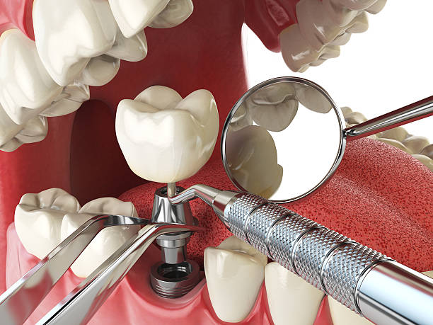 Best Emergency Treatment for Toothache in Branchville, SC